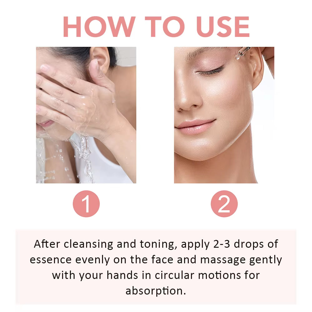 Niacinamide Serum Removal Melanin Fade Melasma Dark Spots Corrector Shrink Pores Brightening Moisturizing Face Serum Skin Care