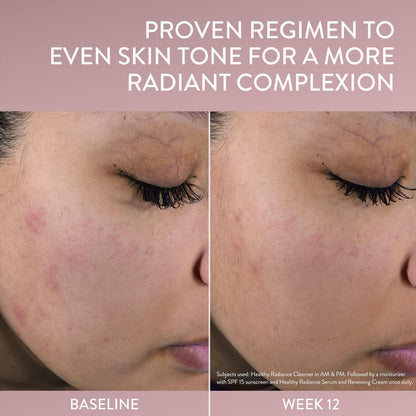 Healthy Radiance Brightening Skin Care Bundle with Face Day Cream, Night Cream, Facial Toner with Niacinamide for Sensitive Skin Prone to Pigmentation, Dermatologist Recommended