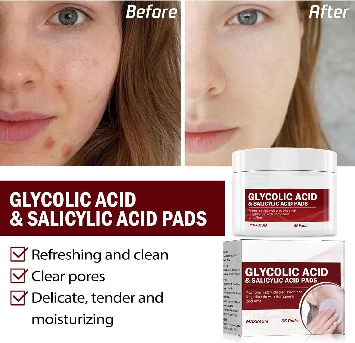 Salicylic & Glycolic Acid Cleansing Pads - Exfoliating Face Pads - Acne Treatment - Reduce Dark Spots, Even Skin Tone (Pack of 55)