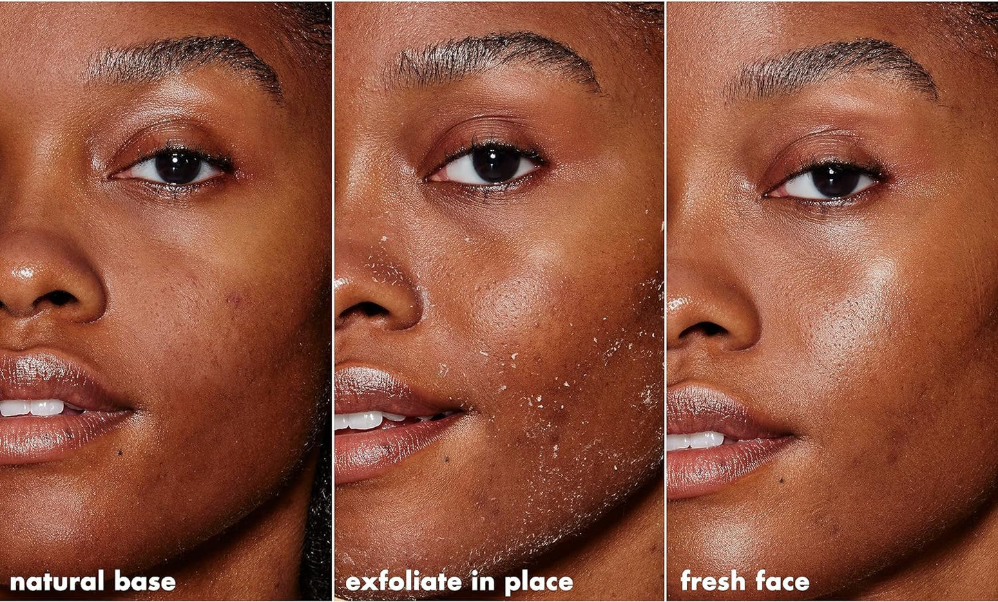 SKIN Gentle Peeling Exfoliant, Cleanser, Effective, Easy to Apply, Peels Away Dead Skin, Removes Dirt, Ideal for All Skin Types