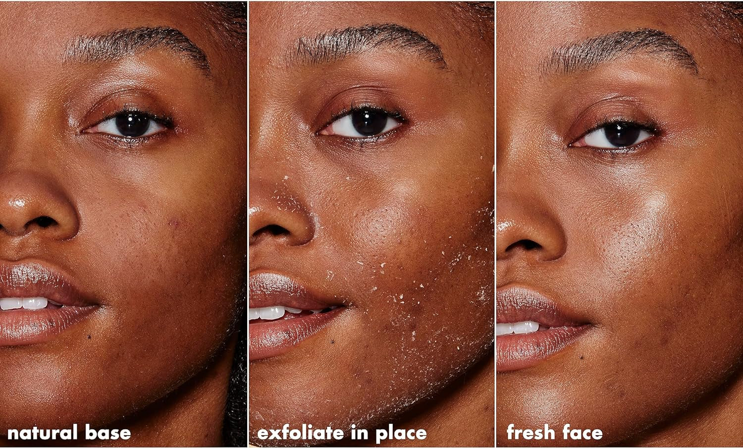 SKIN Gentle Peeling Exfoliant, Cleanser, Effective, Easy to Apply, Peels Away Dead Skin, Removes Dirt, Ideal for All Skin Types