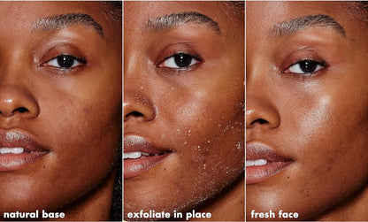 SKIN Gentle Peeling Exfoliant, Cleanser, Effective, Easy to Apply, Peels Away Dead Skin, Removes Dirt, Ideal for All Skin Types