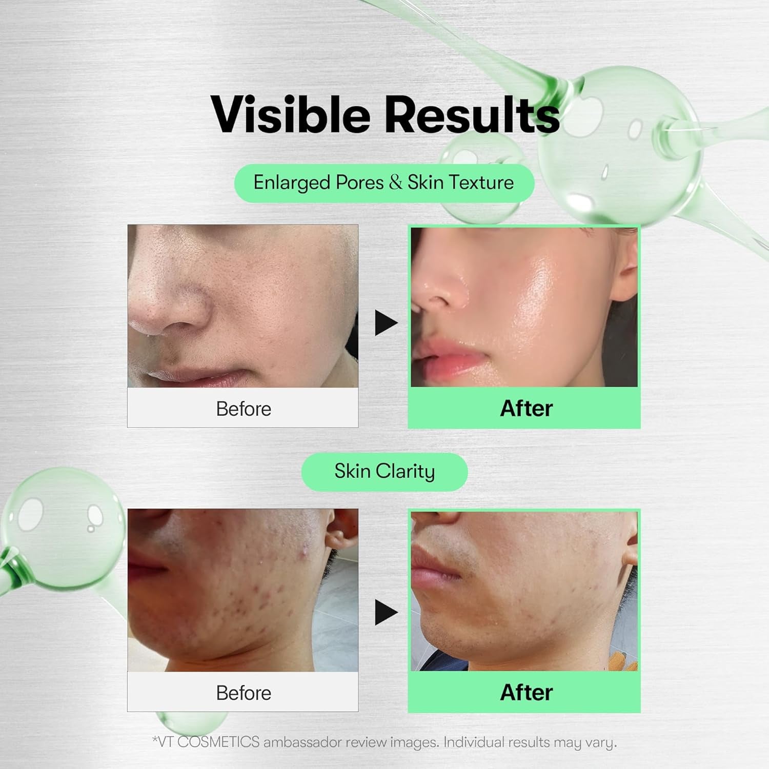 Transform Your Skin with CICA Reedle Shot 100 - The Ultimate Microneedling Serum for Radiant, Glass-Like Complexion!