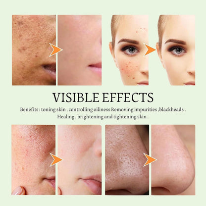 Revitalize Your Skin with the Green Tea Deep Cleanse Mask Stick - Powerful Blackhead Remover & Moisturizer for All Skin Types