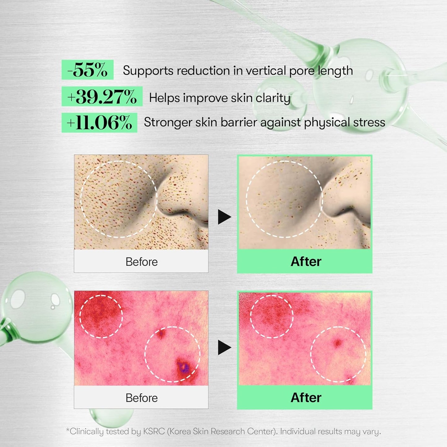 Transform Your Skin with CICA Reedle Shot 100 - The Ultimate Microneedling Serum for Radiant, Glass-Like Complexion!