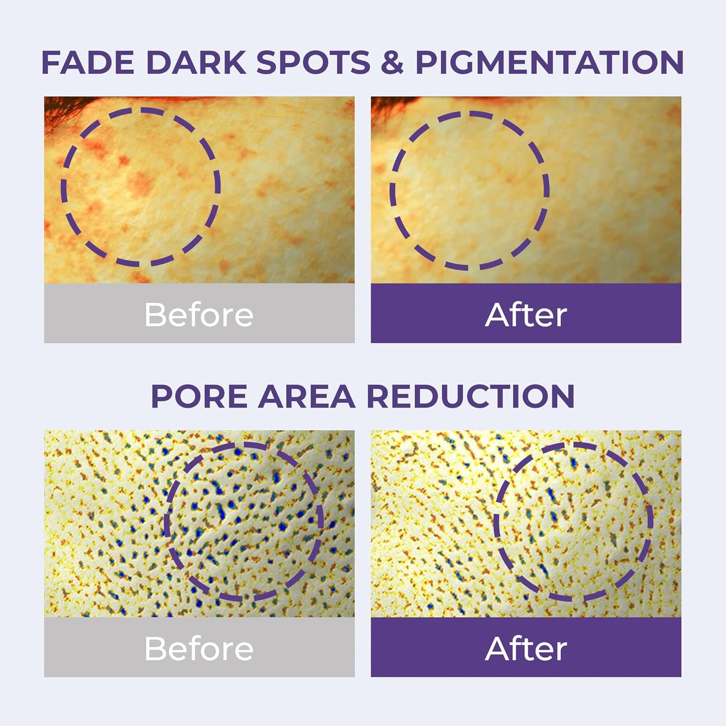 - Korean Face Serum Ampoule Pore Minimizing, Anti-Aging, Elasticity, Hydration, Plump & Dewy Skin | Non-Comedogenic W/ 82% Milk Thistle for Dry, Sensitive & Acne-Prone Skin, Korean Skin Care