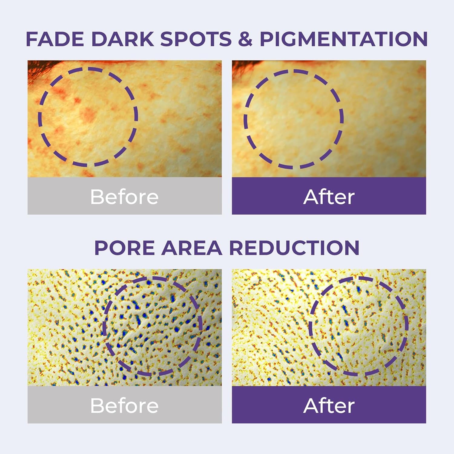 - Korean Face Serum Ampoule Pore Minimizing, Anti-Aging, Elasticity, Hydration, Plump & Dewy Skin | Non-Comedogenic W/ 82% Milk Thistle for Dry, Sensitive & Acne-Prone Skin, Korean Skin Care