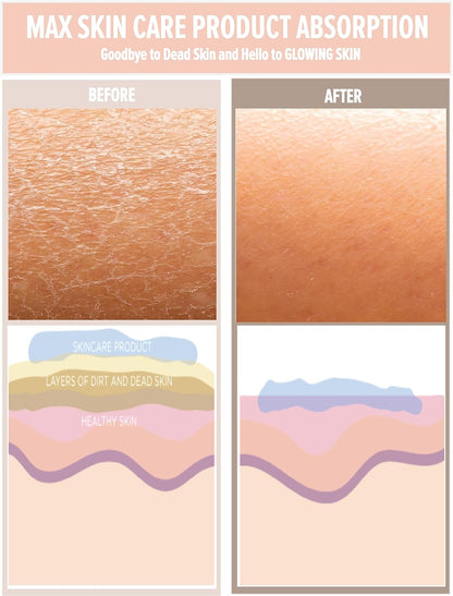 Korean Exfoliating Mitt for Body – Deep Scrub Glove for Dead Skin, Spray Tan Removal, Ingrown Hairs & KP – Korean Spa-Style Viscose Peeling Towel for Shower or Bath – 1 Count