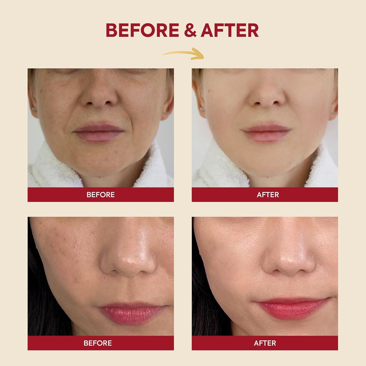 SEOUL 1988 Essence : Snail Mucin 97% + Rice, 100Ml/3.38Fl.Oz. | 97% Snail Secretion with Rice Ferment Filtrate and Rice Extract for Skin Hydration, Soothing | Korean Skincare |