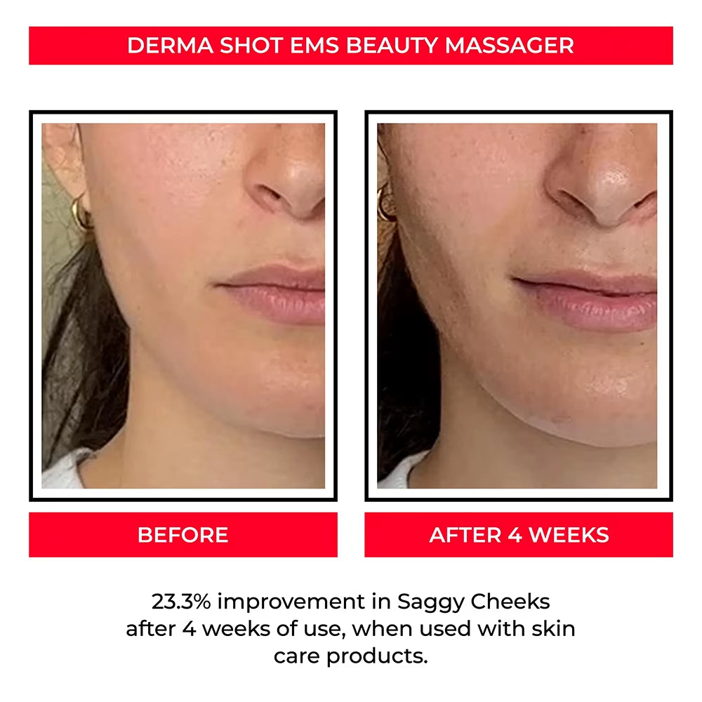 Revitalize Your Skin with the EMS Face Lifting Machine - Microcurrent Roller for Tightening, Rejuvenation, and Double Chin Removal